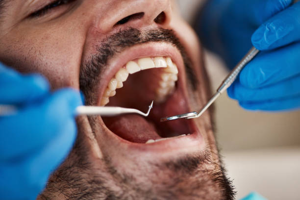 Best Pediatric Emergency Dentist in Castalia, OH