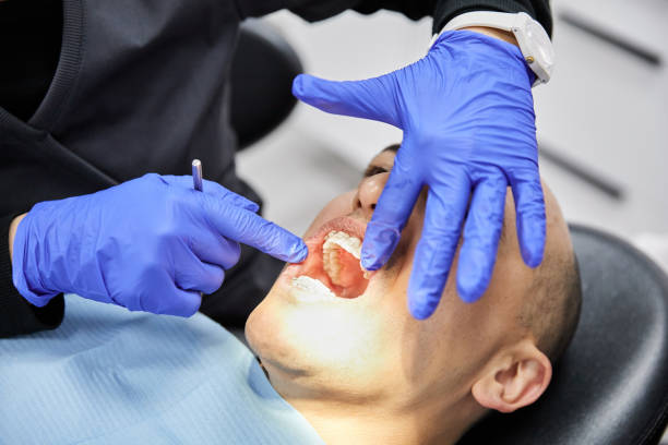 Best Emergency Dentist for Knocked-Out Tooth in Castalia, OH